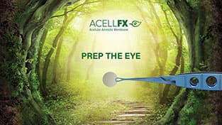 AcellFX How to video - Chapter 1: Prep the Eye