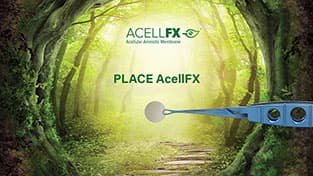 AcellFX How to video - Chapter 3: Place AcellFX