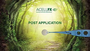 AcellFX How to video - Chapter 4: Post Application